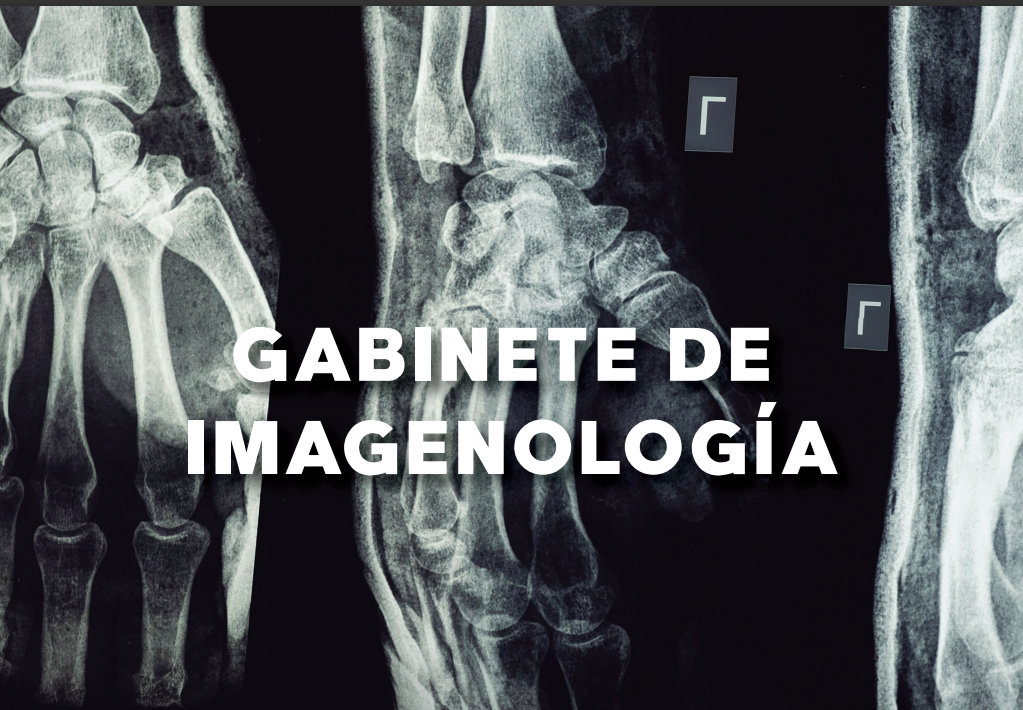 Imagen 3