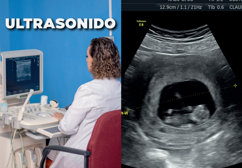 Imagen 3